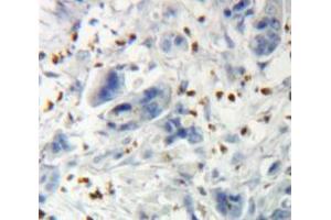 Used in DAB staining on fromalin fixed paraffin-embedded Pancreas tissue (THRB 抗体  (AA 239-457))