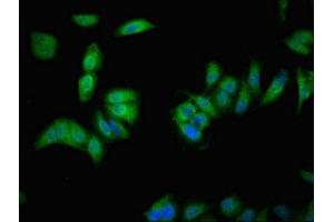 Immunofluorescent analysis of Hela cells using ABIN7175549 at dilution of 1:100 and Alexa Fluor 488-congugated AffiniPure Goat Anti-Rabbit IgG(H+L) (VMO1 抗体  (AA 25-202))