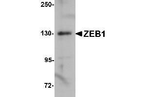 Western Blotting (WB) image for anti-Zinc Finger E-Box Binding Homeobox 1 (ZEB1) (Middle Region) antibody (ABIN1031173) (ZEB1 抗体  (Middle Region))