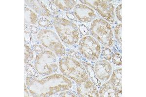Immunohistochemistry of paraffin-embedded Mouse kidney using RPS18 antibody (ABIN6128660, ABIN6147205, ABIN6147206 and ABIN6215379) at dilution of 1:100 (40x lens). (RPS18 抗体  (AA 1-152))