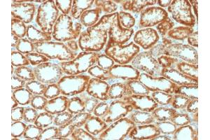 Formalin-fixed, paraffin-embedded human Renal Cell Carcinoma stained with Erythropoietin Mouse Monoclonal Antibody (EPO/1368). (EPO 抗体  (AA 28-162))