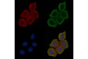 ABIN6264209 and ABIN6272607 staining Hela cells(24h of starvation treatment) by IF/ICC.