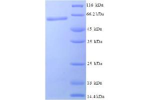SDS-PAGE (SDS) image for MTB2 (AA 1-360), (full length) protein (His-SUMO Tag) (ABIN5711367) (MTB2 (AA 1-360), (full length) protein (His-SUMO Tag))