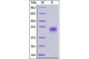Cynomolgus CD32a, His Tag (SPR & BLI & HPLC verified) on  under reducing (R) condition. (FCGR2A Protein (AA 28-208) (His tag))