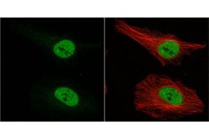 Immunofluorescence (IF) image for anti-Musashi Homolog 1 (Drosophila) (MSI1) (Center) antibody (ABIN2855085)