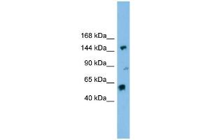 WB Suggested Anti-DHX8 Antibody Titration: 0. (DHX8 抗体  (N-Term))