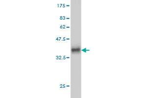 Western Blotting (WB) image for anti-Histidyl-tRNA Synthetase (HARS1) (AA 1-96) antibody (ABIN561226)