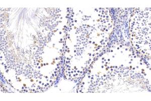 Immunohistochemistry (IHC) image for anti-Ubiquitin Carboxyl-terminal Esterase L1 (Ubiquitin Thiolesterase) (UCHL1) (AA 2-223) antibody (ABIN7436393)
