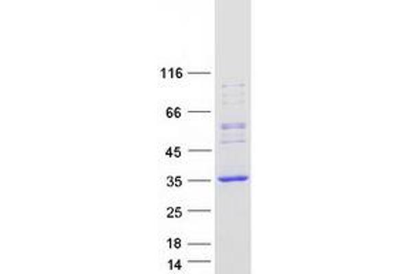 REP15 Protein (Myc-DYKDDDDK Tag)