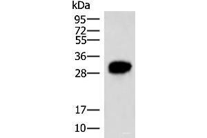 Western blot analysis of HepG2 cell lysate using HCCS Polyclonal Antibody at dilution of 1:4000 (HCCS 抗体)