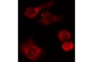 anti-Lymphocyte-Specific Protein 1 (LSP1) (C-Term) antibody