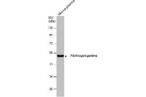 Western Blotting (WB) image for anti-Fibrinogen gamma Chain (FGG) antibody (ABIN2856626)