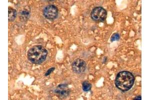 Detection of FABP1 in Mouse Liver Tissue using Polyclonal Antibody to Fatty Acid Binding Protein 1 (FABP1) (FABP1 抗体  (AA 1-127))