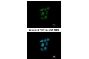 ICC/IF Image Immunofluorescence analysis of paraformaldehyde-fixed A431, using NR0B2, antibody at 1:500 dilution.
