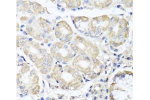 Immunohistochemistry (Paraffin-embedded Sections) (IHC (p)) image for anti-Optic Atrophy 3 (Autosomal Recessive, with Chorea and Spastic Paraplegia) (OPA3) antibody (ABIN7264051)