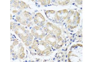 Immunohistochemistry of paraffin-embedded Human stomach using OPA3 Polyclonal Antibody at dilution of 1:100 (40x lens). (OPA3 抗体)