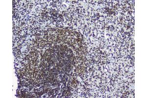 IHC analysis of TPR using anti-TPR antibody (ABIN5693275). (TPR 抗体)