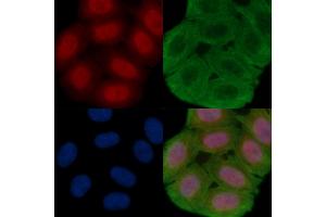 ABIN6261112 and ABIN6277999 staining Hela cells(30 min of UV treatment) by IF/ICC.