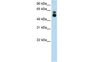 HDAC9 antibody used at 1. (HDAC9 抗体  (C-Term))