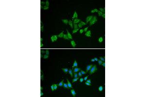 Immunofluorescence (IF) image for anti-BCL2/adenovirus E1B 19kDa Interacting Protein 2 (BNIP2) antibody (ABIN1980298) (BNIP2 抗体)