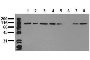 Western Blotting (WB) image for anti-Catenin (Cadherin-Associated Protein), alpha 1, 102kDa (CTNNA1) antibody (ABIN126738)