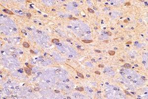 Immunohistochemistry analysis of paraffin-embedded mouse brain using,DAK (ABIN7073737) at dilution of 1: 5000 (DAK 抗体)