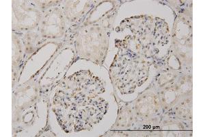 Immunoperoxidase of monoclonal antibody to CSDA on formalin-fixed paraffin-embedded human kidney. (CSDA 抗体  (AA 241-330))