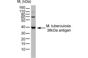 Western Blotting (WB) image for anti-Mycobacterium Tuberculosis (CFP10) antibody (ABIN316622) (CFP10 抗体)