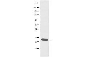 Western blot analysis of extracts from A549 cells, using MRPL13 antibody. (MRPL13 抗体  (C-Term))