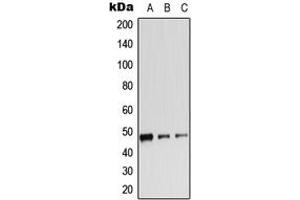 Western Blotting (WB) image for anti-Adrenergic, beta-2-, Receptor, Surface (ADRB2) (C-Term), (pSer346) antibody (ABIN7294870)