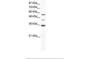 Image no. 1 for anti-ALX Homeobox 4 (ALX4) (AA 31-80) antibody (ABIN202460) (ALX4 抗体  (AA 31-80))