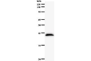 Western Blotting (WB) image for anti-NIMA related kinase 4 (NEK4) antibody (ABIN931149) (NEK4 抗体)