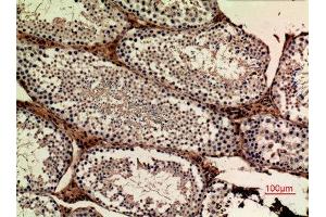 Immunohistochemistry (IHC) analysis of paraffin-embedded Mouse Ovary, antibody was diluted at 1:100.