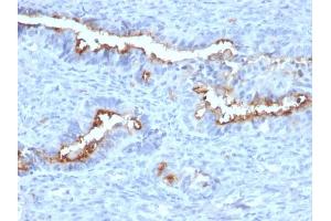 Formalin-fixed, paraffin-embedded human Endometrium stained with Podocalyxin Mouse Monoclonal Antibody (PODXL/2184). (PODXL 抗体  (AA 310-447))