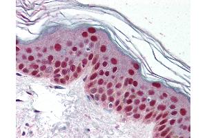 Anti-CDK9 antibody IHC of human skin. (CDK9 抗体)