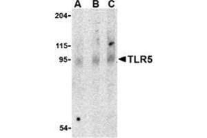 Western blot analysis of TLR5 in rat brain cell lysate with this product at (A) 0. (TLR5 抗体  (Center))
