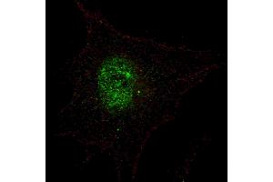 Fluorescent confocal image of SY5Y cells stained with phospho-PDX1-T11 antibody. (PDX1 抗体  (pThr11))