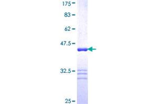 FLNC Protein (AA 2606-2705) (GST tag)