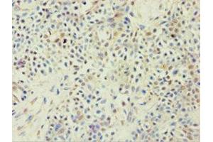 Immunohistochemistry (IHC) image for anti-ATP-Binding Cassette, Sub-Family F (GCN20), Member 2 (ABCF2) (AA 1-250) antibody (ABIN7144925)