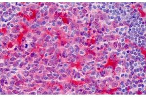 Immunohistochemistry (Formalin-fixed Paraffin-embedded Sections) (IHC (fp)) image for anti-Pleckstrin (PLEK) (AA 121-231) antibody (ABIN574318)