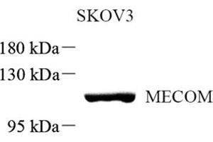 Western blot analysis of MECOM (ABIN7074575) at dilution of 1: 500 (MECOM 抗体)