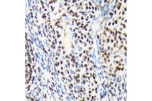 Immunohistochemistry of paraffin-embedded rat ovary using A Rabbit mAb (ABIN7265699) at dilution of 1:100 (40x lens).