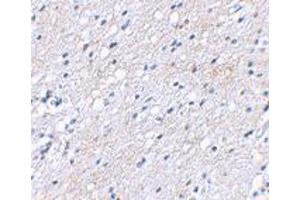 Immunohistochemical staining of human brain tissue using BAIAP3 polyclonal antibody  at 2. (BAIAP3 抗体  (N-Term))