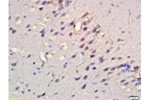 Formalin-fixed and paraffin embedded rat brain labeled with Rabbit Anti-RPS6KB1(Ser427) Polyclonal Antibody, Unconjugated  at 1:200 followed by conjugation to the secondary antibody and DAB staining (RPS6KB1 抗体  (pSer427))