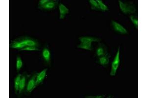 Immunofluorescent analysis of Hela cells using ABIN7160373 at dilution of 1:100 and Alexa Fluor 488-congugated AffiniPure Goat Anti-Rabbit IgG(H+L) (MSH4 抗体  (AA 501-800))