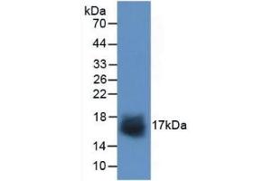 Detection of Recombinant SNCa, Human using Polyclonal Antibody to Synuclein Alpha (SNCa) (SNCA 抗体  (AA 1-140))