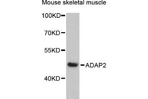 Western blot analysis of extracts of mouse skeletal muscle, using  antibody (ABIN6131170, ABIN6136549, ABIN6136551 and ABIN6217841) at 1:3000 dilution. (ADAP2 抗体  (AA 1-381))