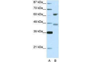 WB Suggested Anti-RFX4 Antibody Titration: 5. (RFX4 抗体  (Middle Region))