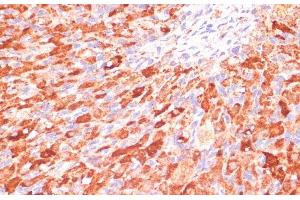 Immunohistochemistry of paraffin-embedded Rat ovary using ASNS Polyclonal Antibody at dilution of 1:100 (40x lens). (Asparagine Synthetase 抗体)