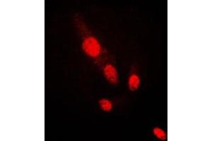 Immunofluorescent analysis of AKT2 staining in HepG2 cells. (AKT2 抗体  (C-Term))